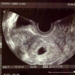 No photo normal square img