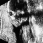 No photo normal square img